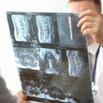Lekarz analizuje zdjęcie rentgenowskie kręgosłupa – diagnostyka osteoporozy i zmian zwyrodnieniowych