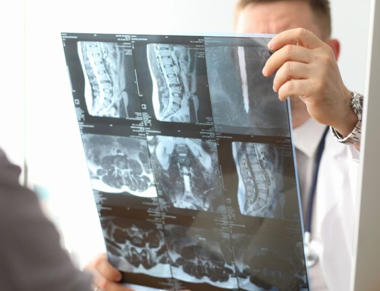 Lekarz analizuje zdjęcie rentgenowskie kręgosłupa – diagnostyka osteoporozy i zmian zwyrodnieniowych
