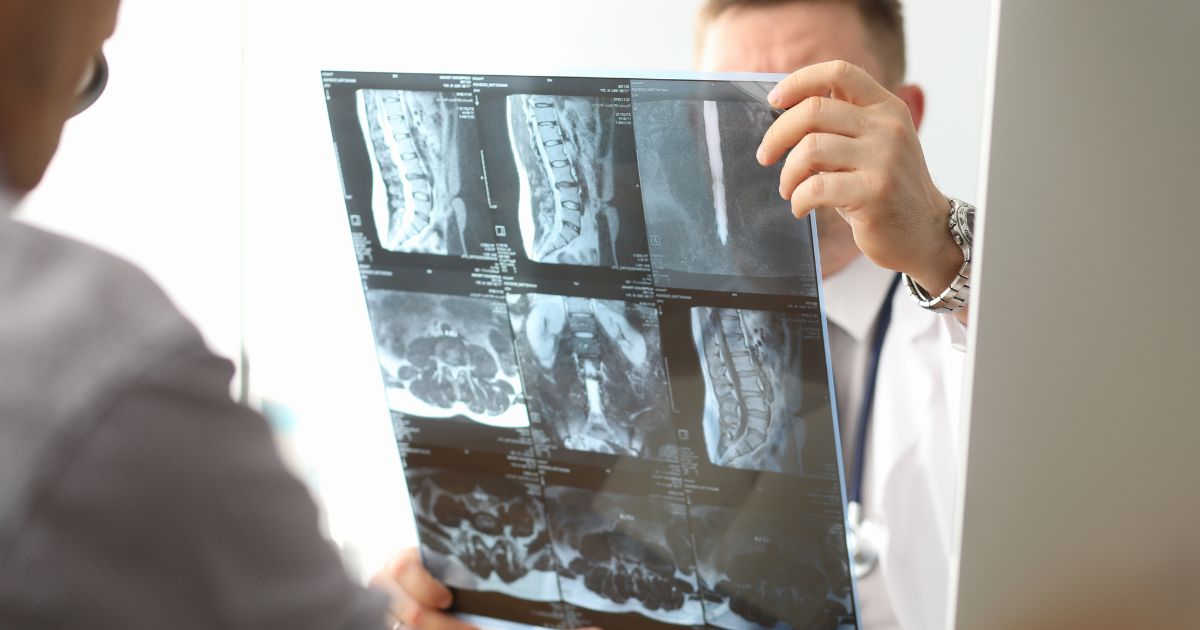 Lekarz analizuje zdjęcie rentgenowskie kręgosłupa – diagnostyka osteoporozy i zmian zwyrodnieniowych